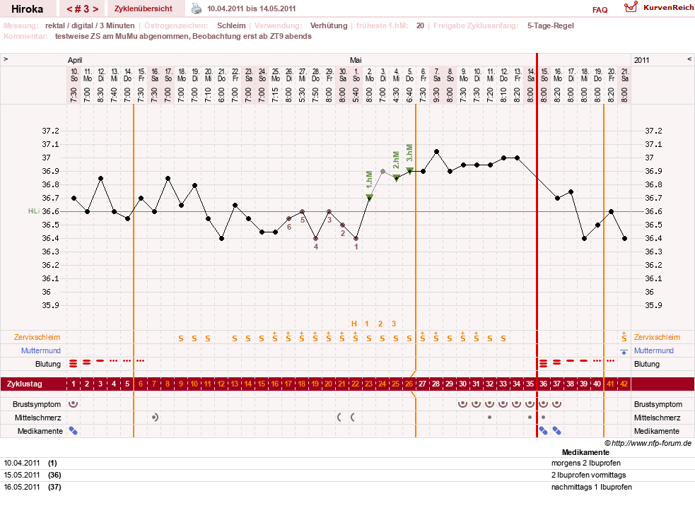 NFP-Kurve User #15010