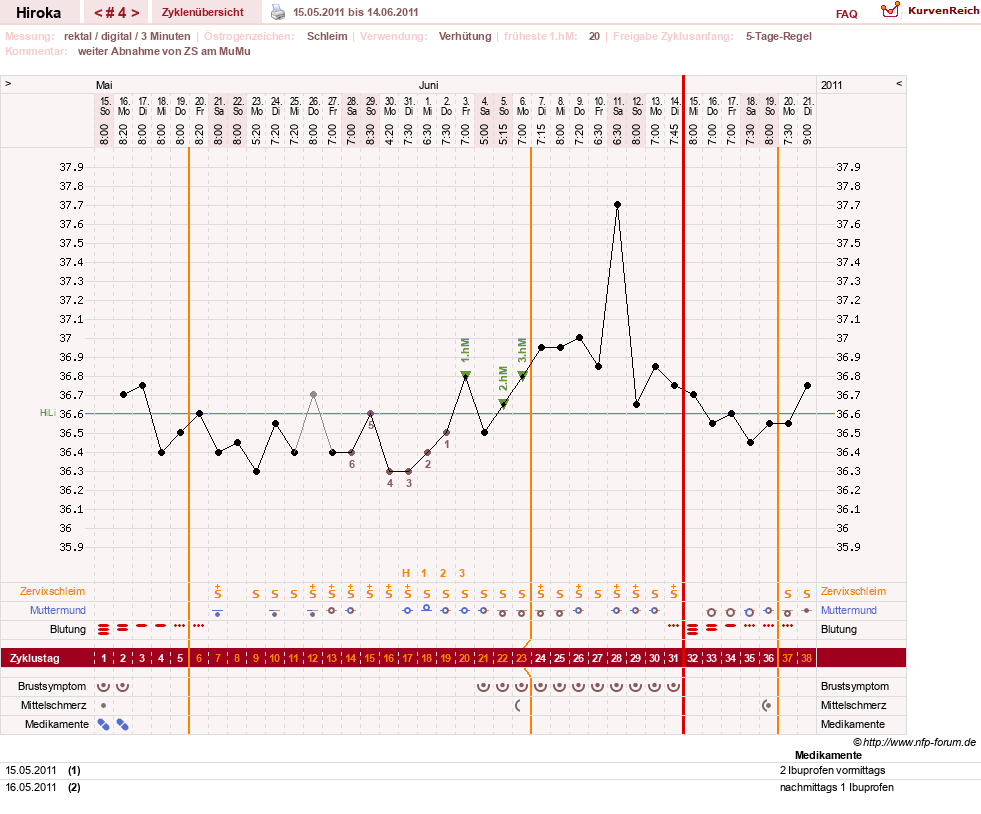 NFP-Kurve User #15010