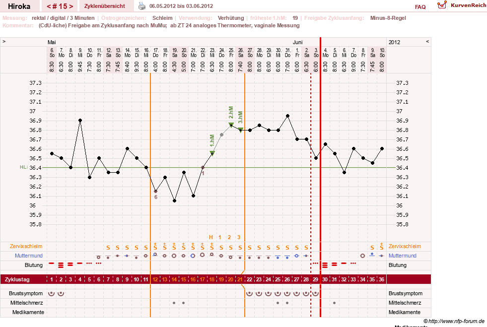 NFP-Kurve User #15010