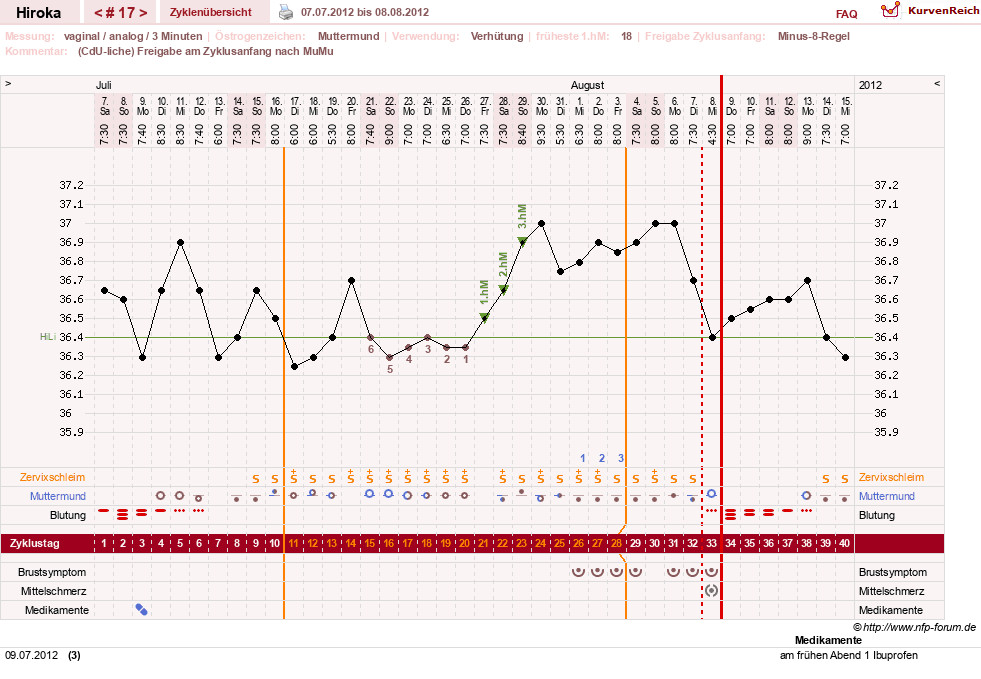 NFP-Kurve User #15010