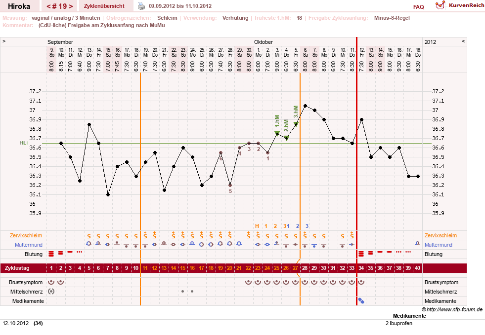 NFP-Kurve User #15010