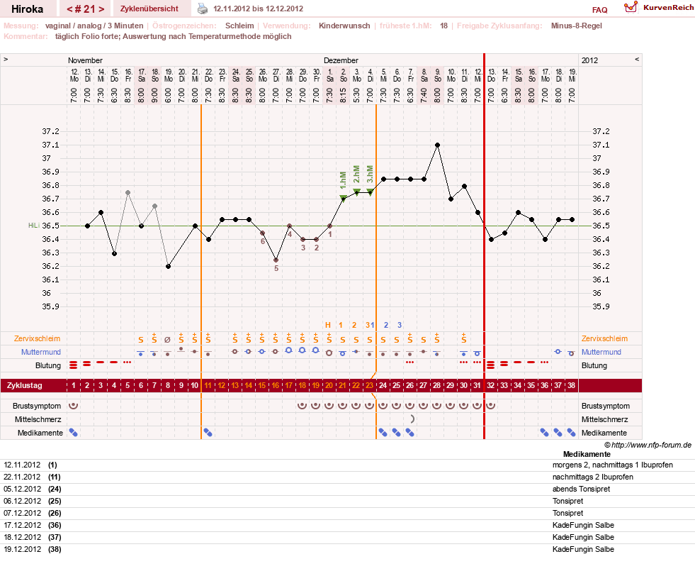 NFP-Kurve User #15010