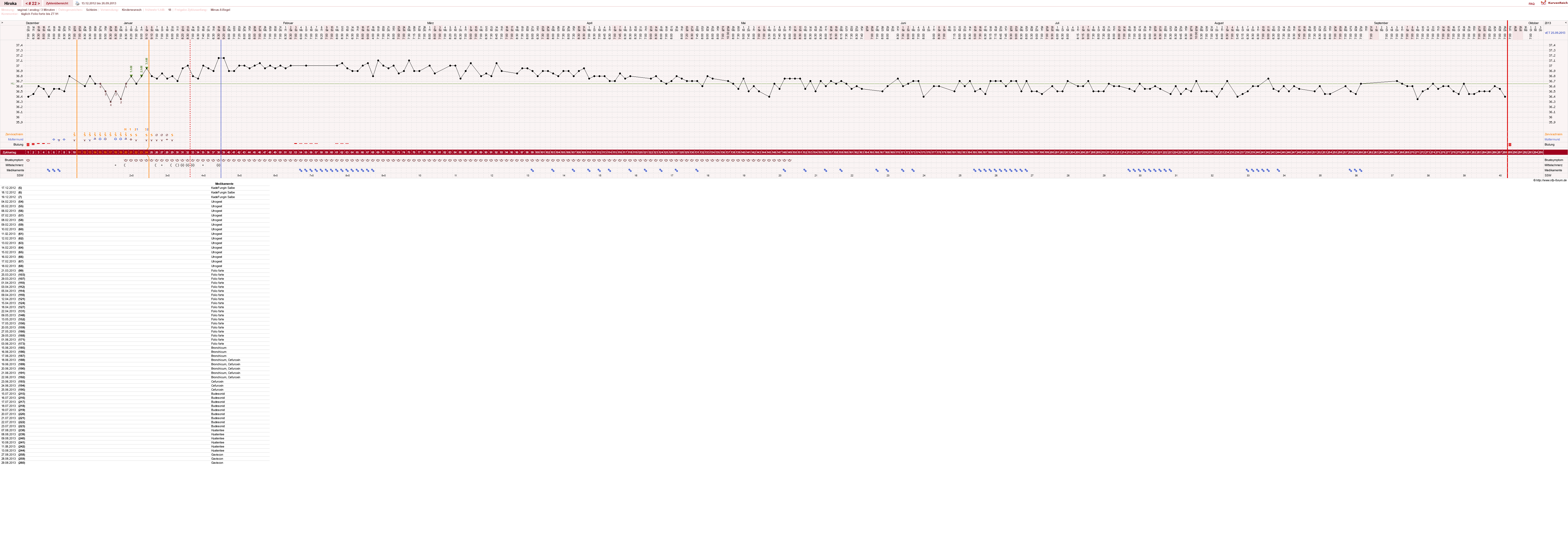 NFP-Kurve User #15010