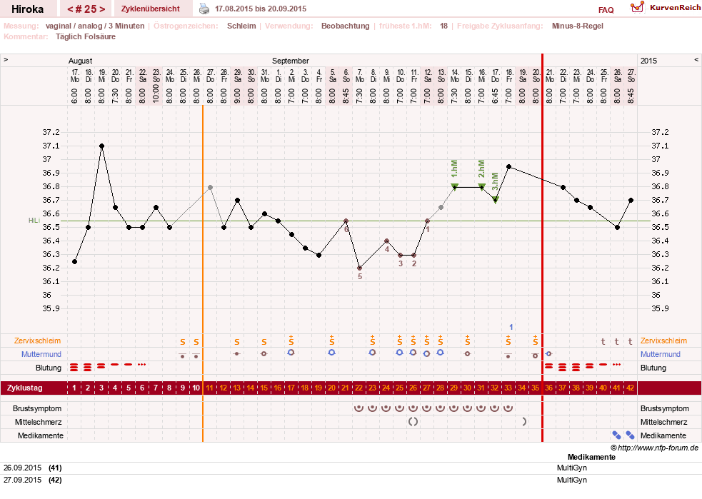 NFP-Kurve User #15010