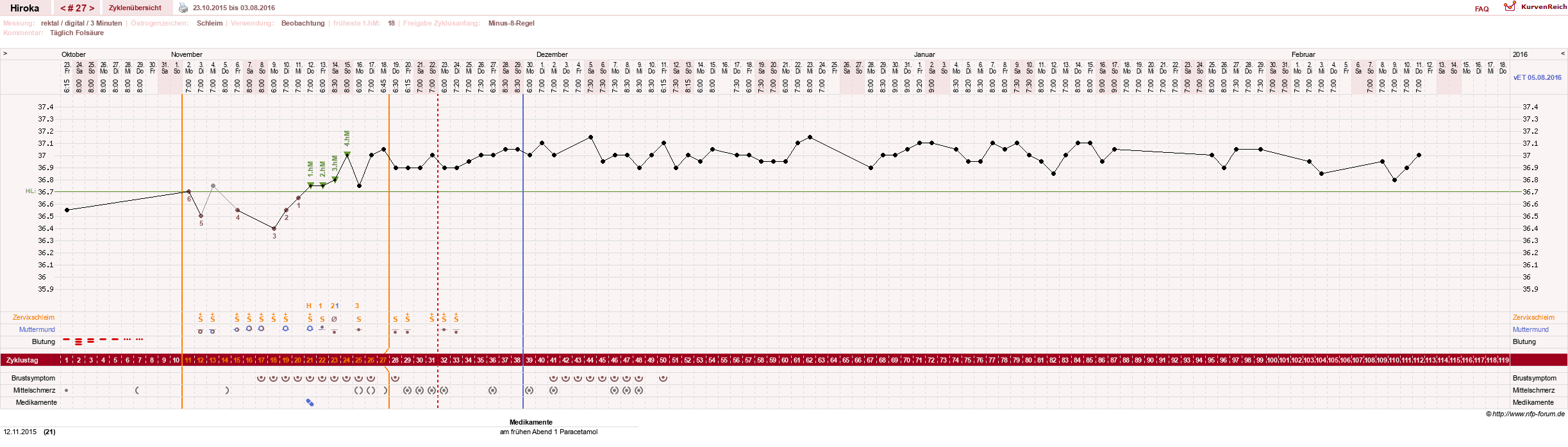 NFP-Kurve User #15010