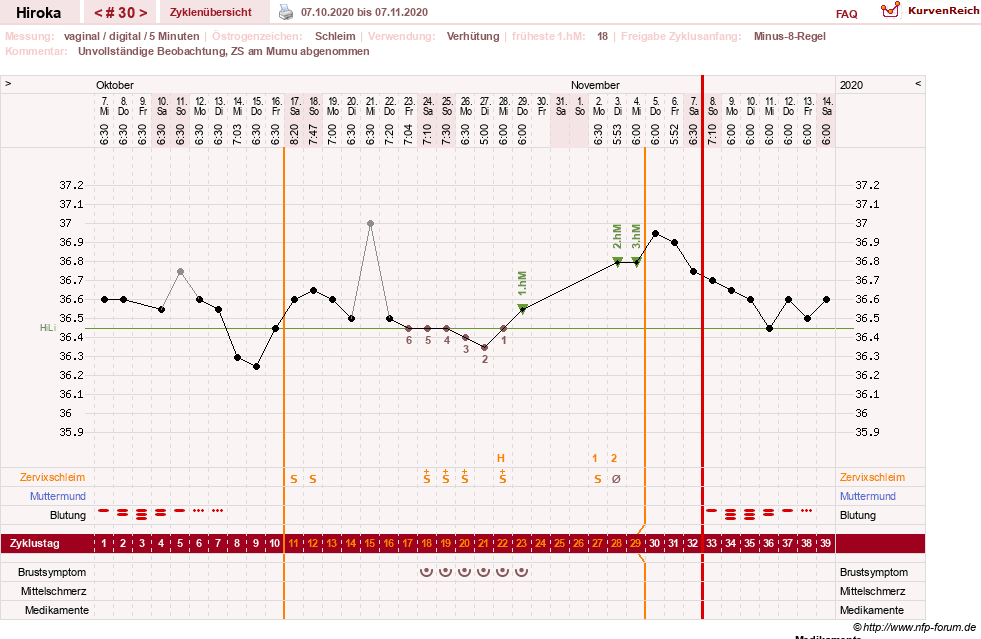 NFP-Kurve User #15010