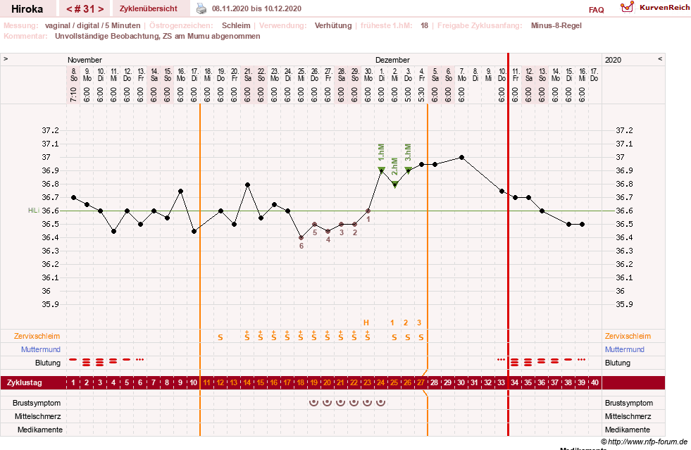 NFP-Kurve User #15010