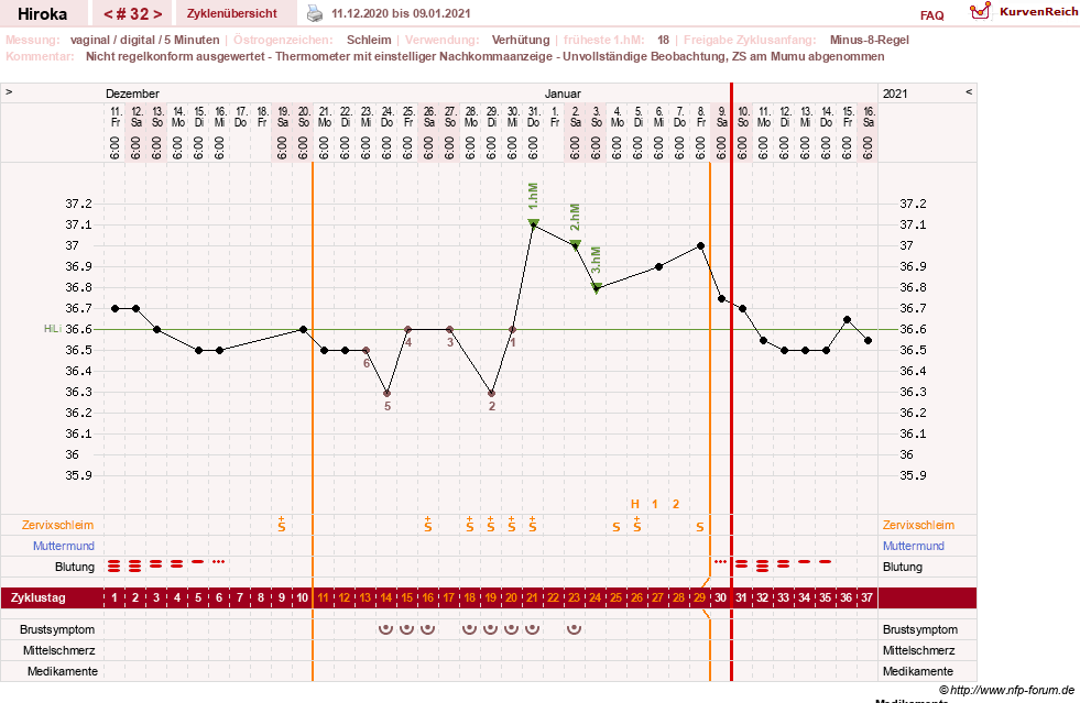 NFP-Kurve User #15010