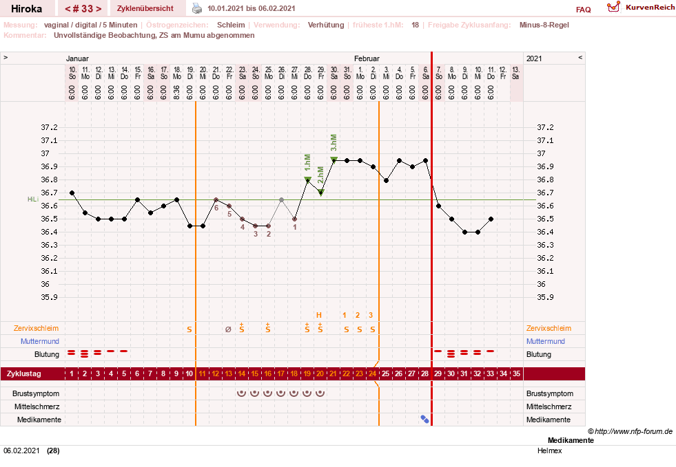 NFP-Kurve User #15010