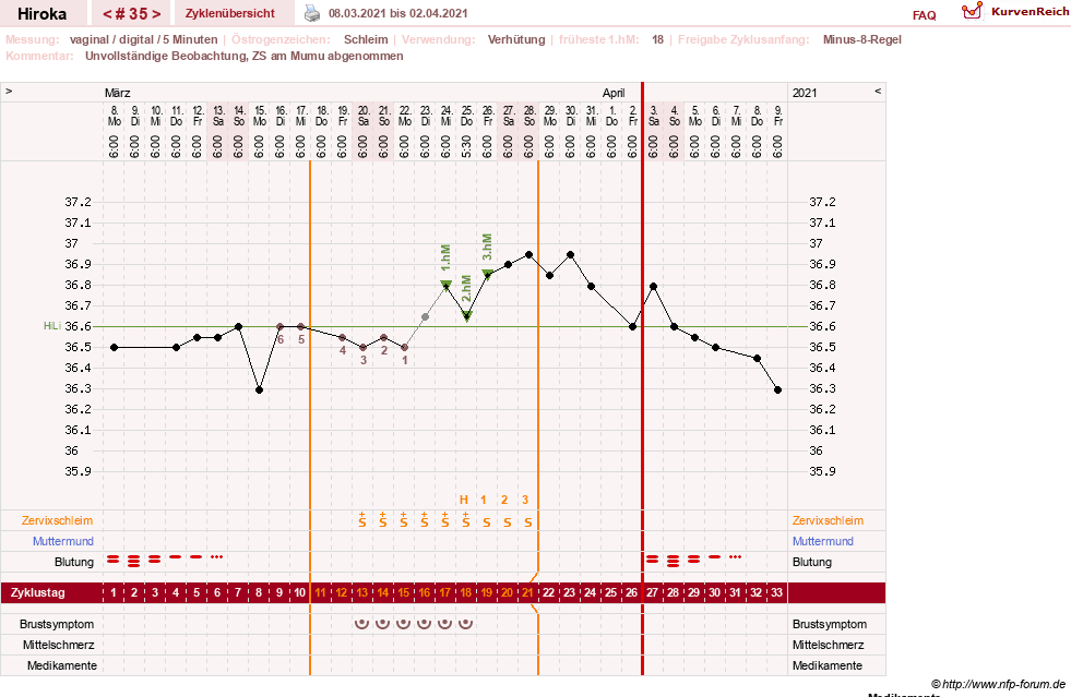 NFP-Kurve User #15010