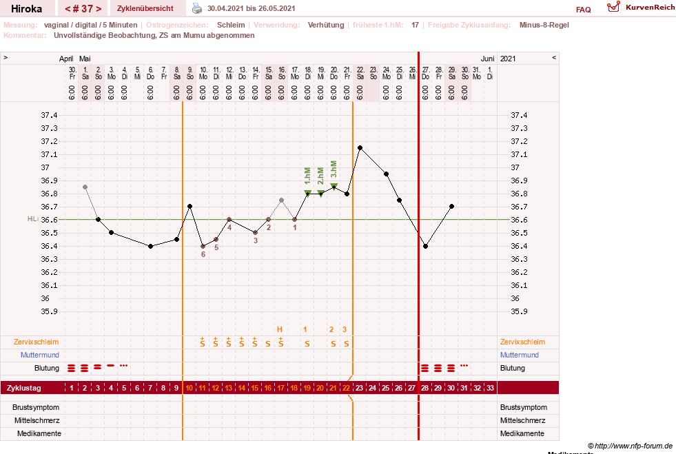NFP-Kurve User #15010