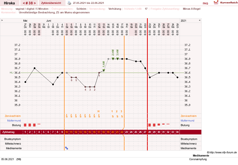 NFP-Kurve User #15010