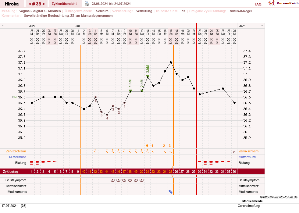 NFP-Kurve User #15010