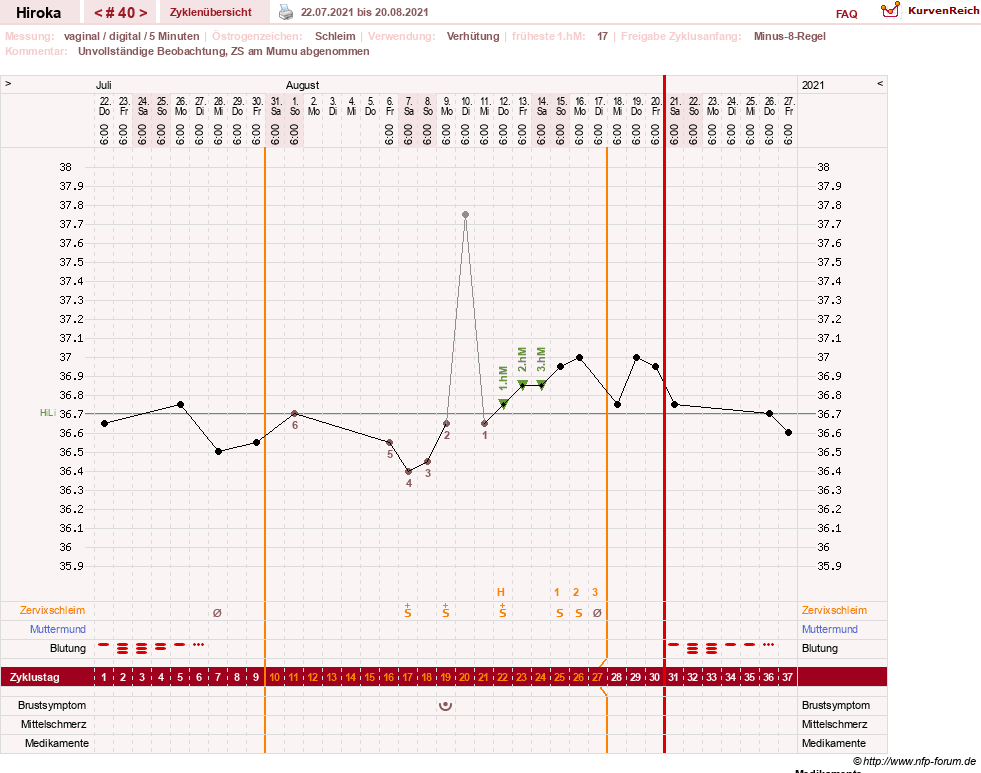 NFP-Kurve User #15010