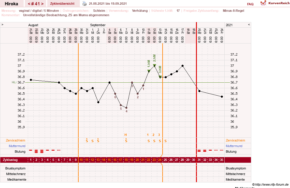 NFP-Kurve User #15010