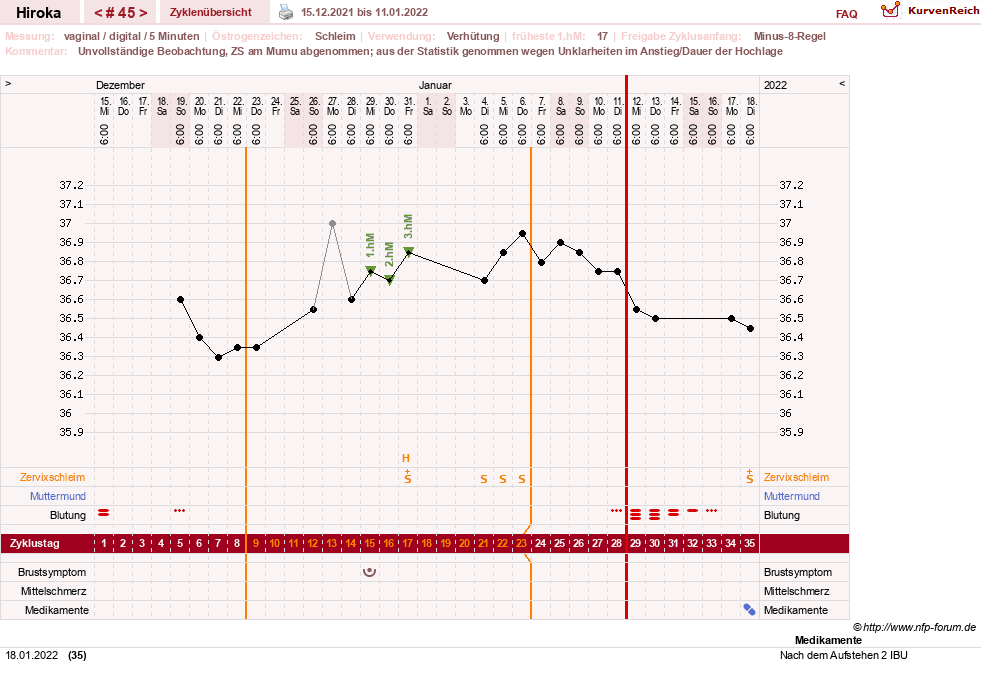 NFP-Kurve User #15010