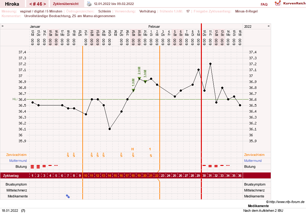 NFP-Kurve User #15010