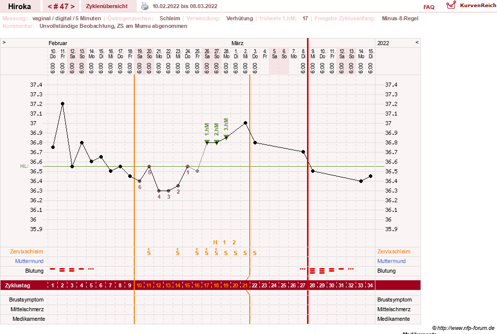 NFP-Kurve User #15010