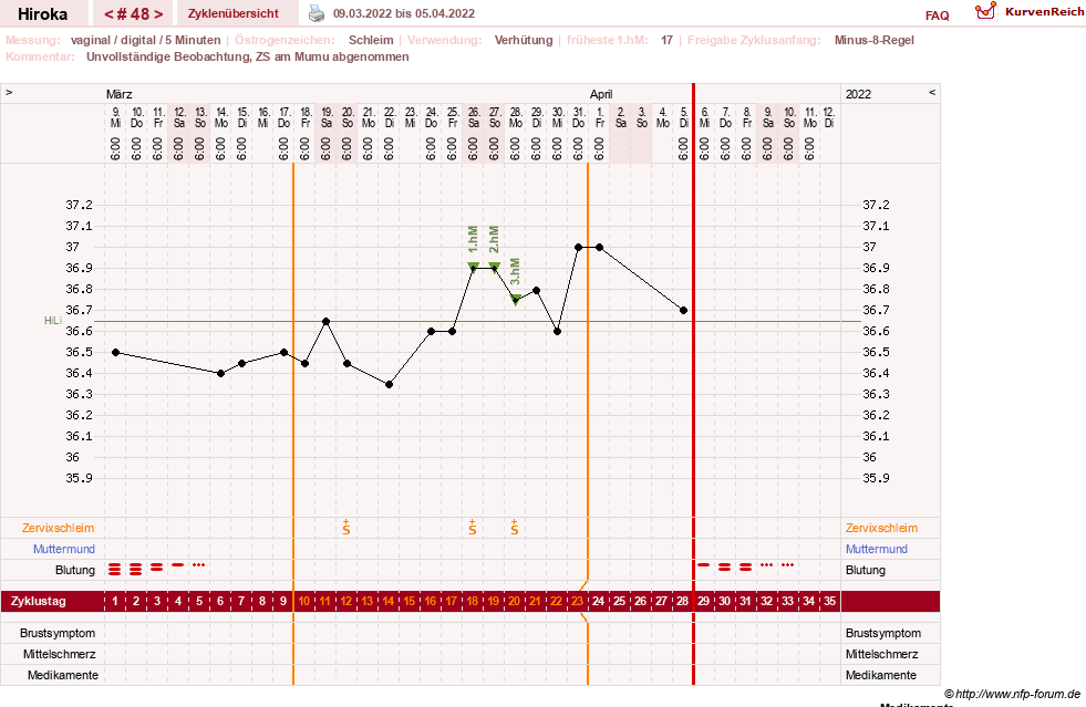 NFP-Kurve User #15010