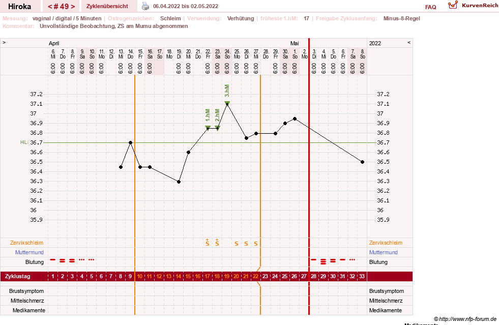 NFP-Kurve User #15010