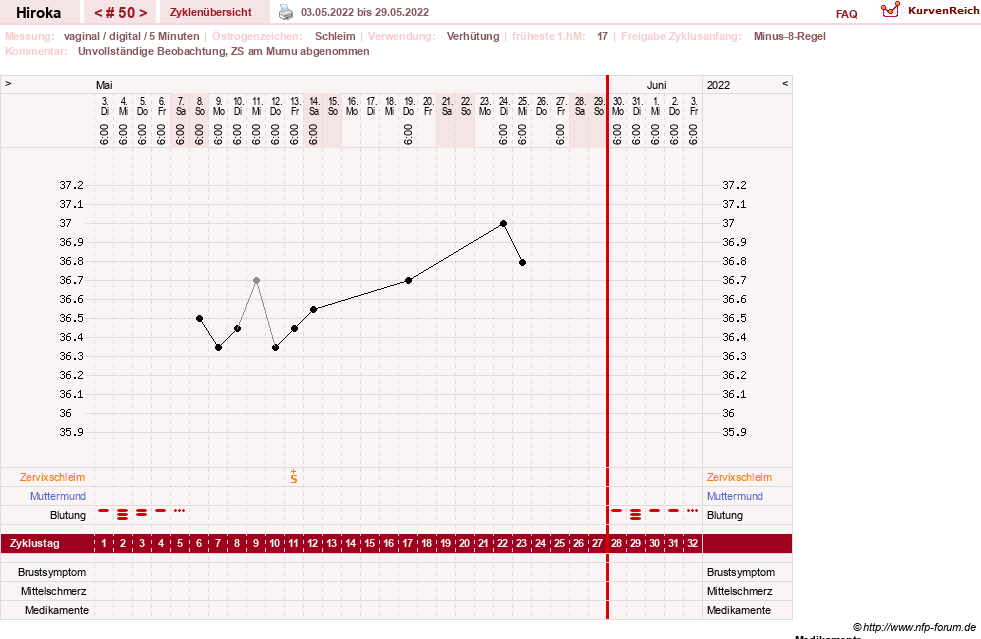 NFP-Kurve User #15010
