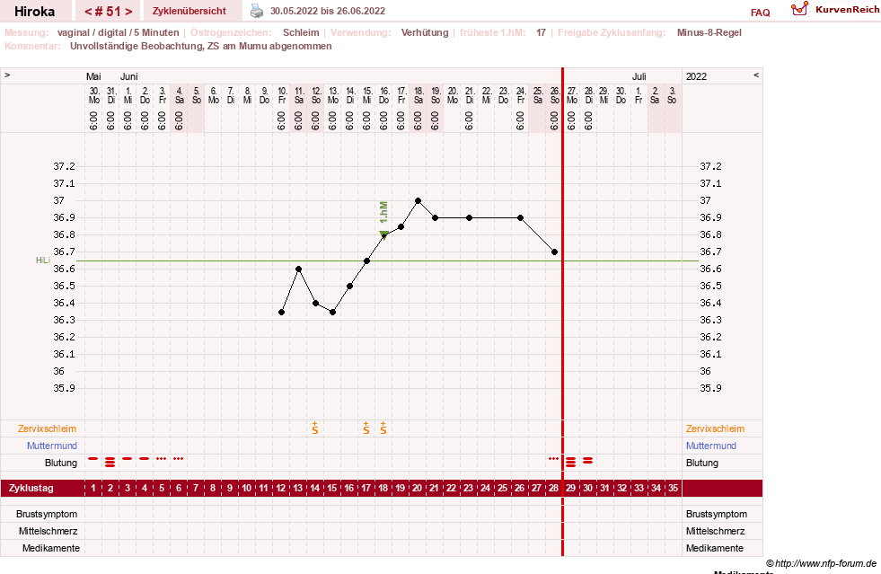 NFP-Kurve User #15010