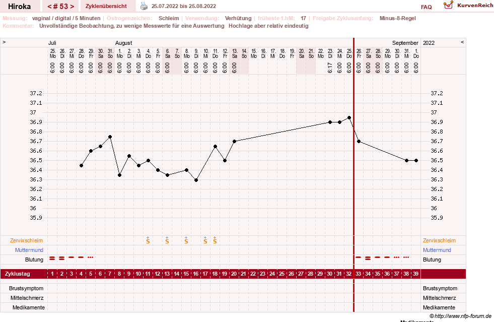 NFP-Kurve User #15010