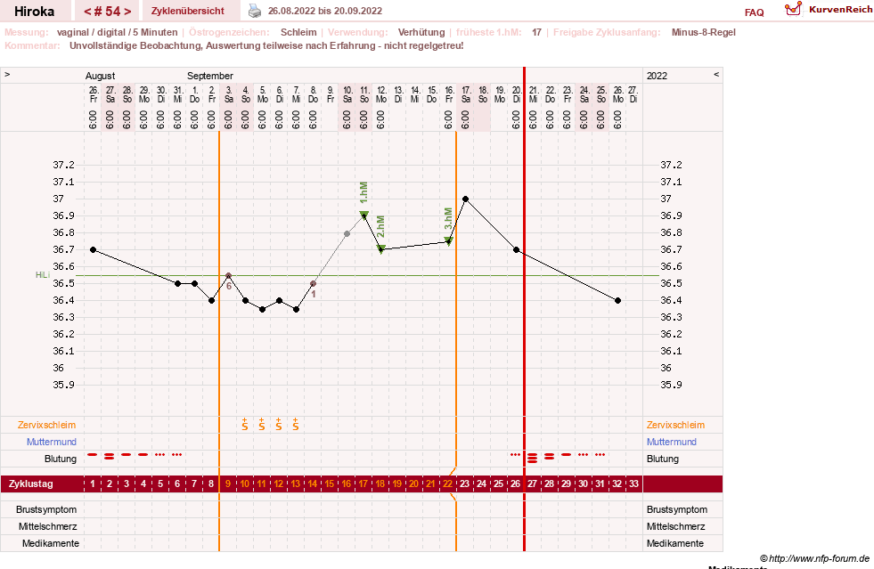 NFP-Kurve User #15010