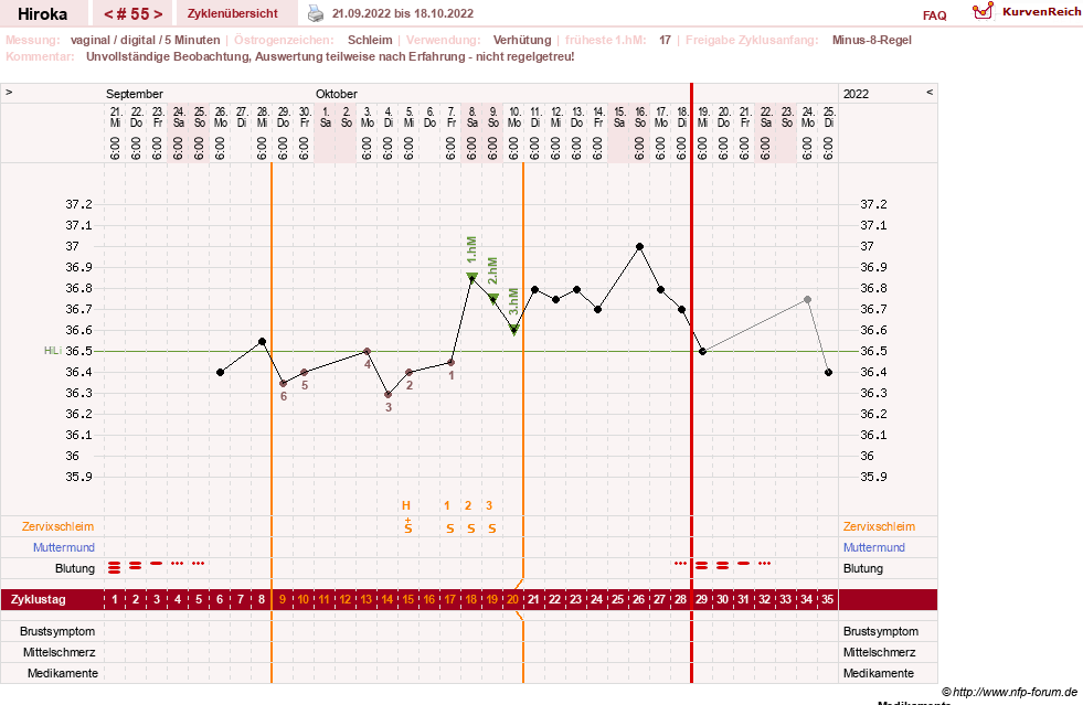 NFP-Kurve User #15010