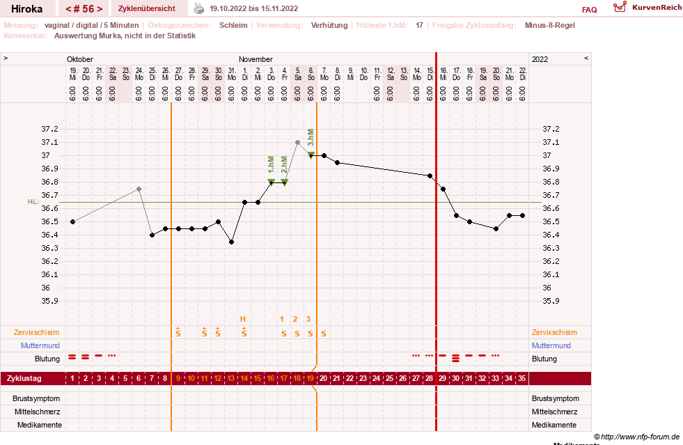 NFP-Kurve User #15010