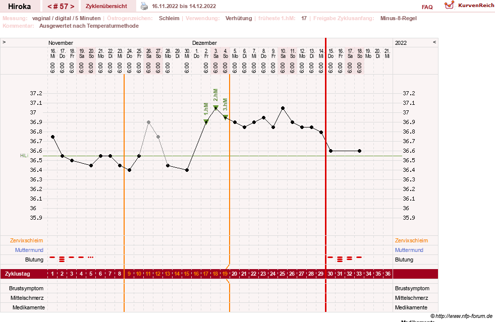 NFP-Kurve User #15010