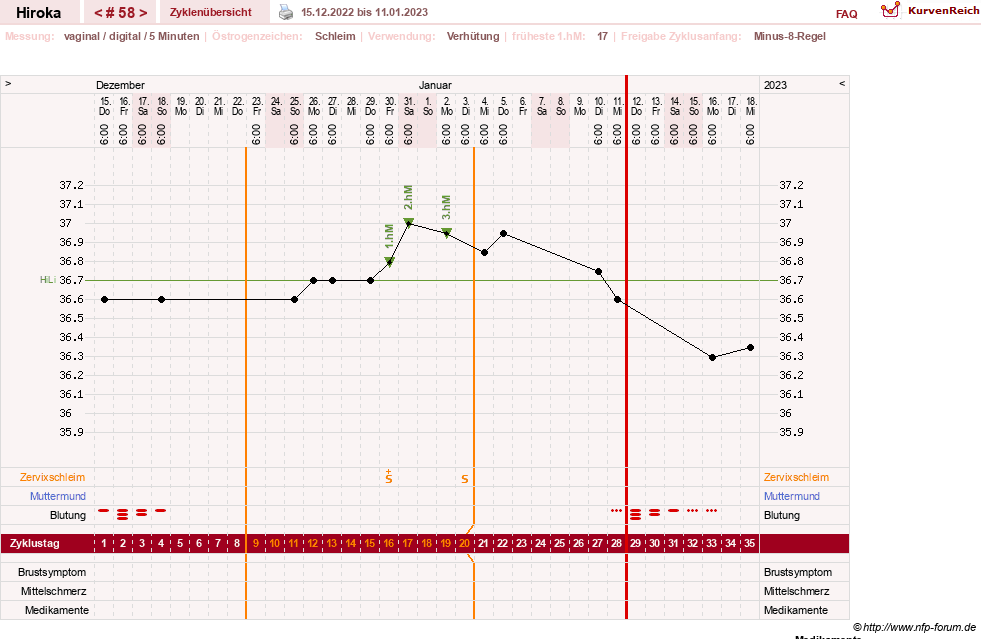 NFP-Kurve User #15010