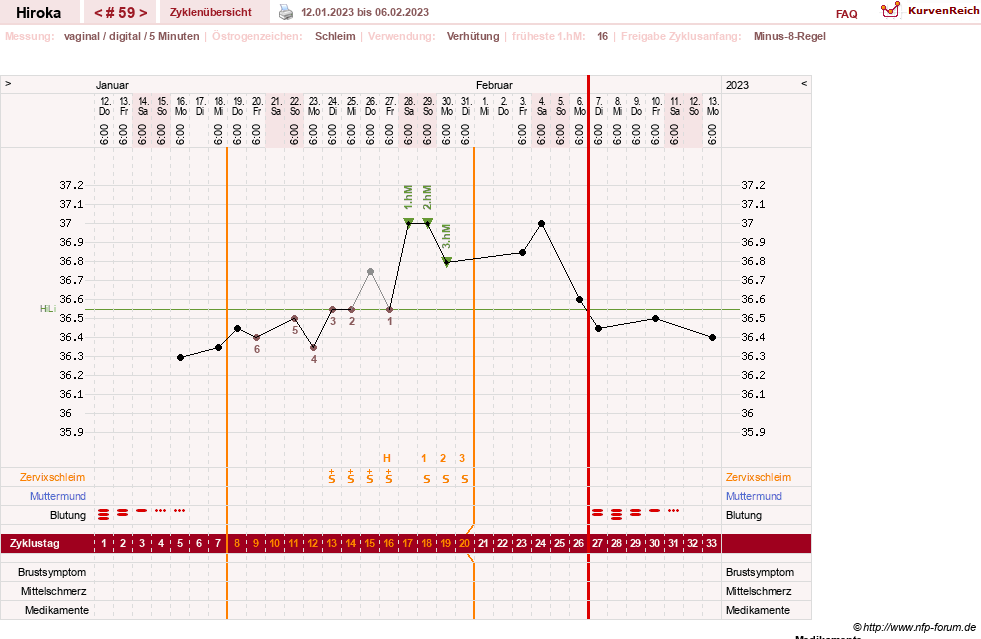 NFP-Kurve User #15010