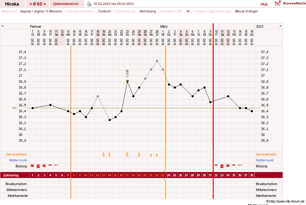 NFP-Kurve User #15010