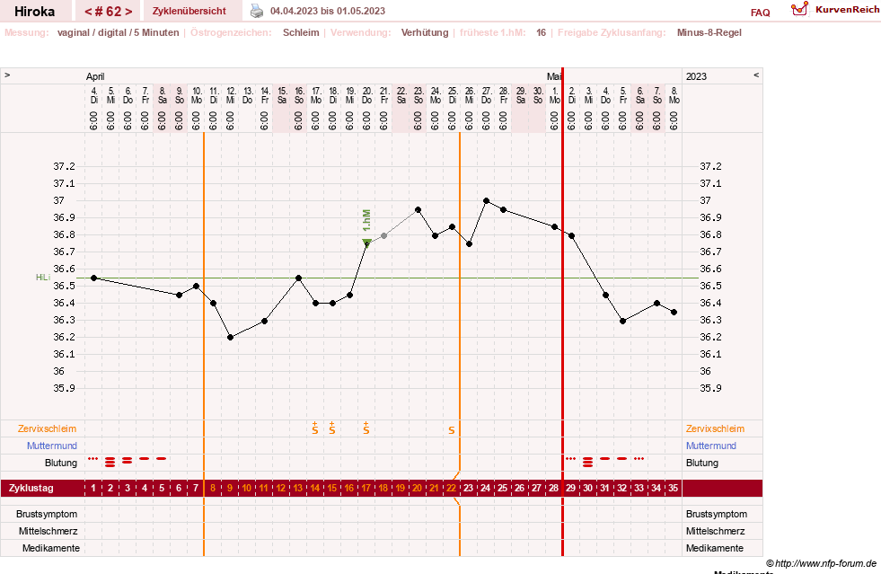 NFP-Kurve User #15010