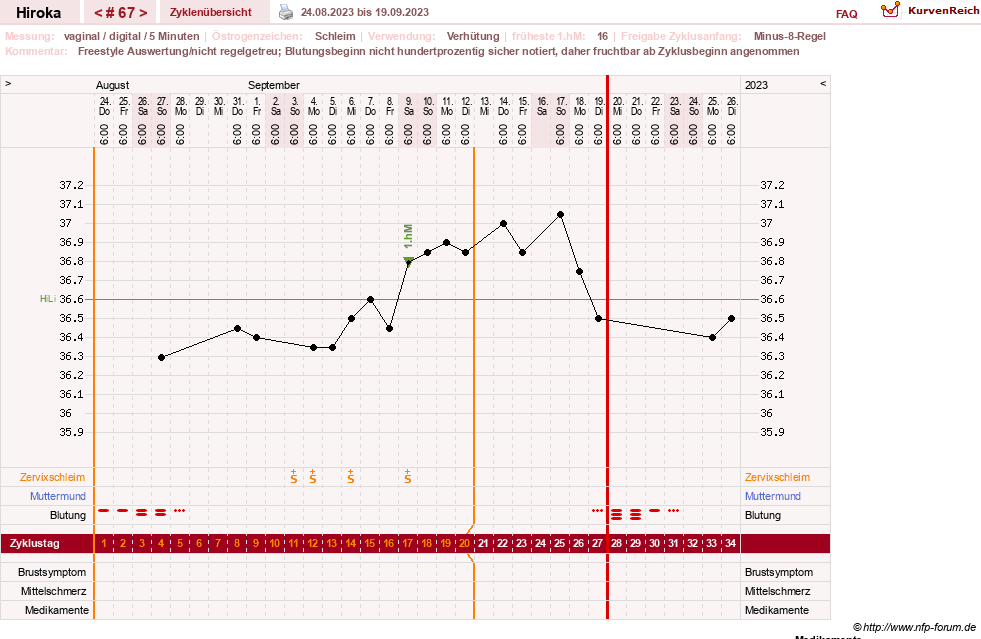 NFP-Kurve User #15010