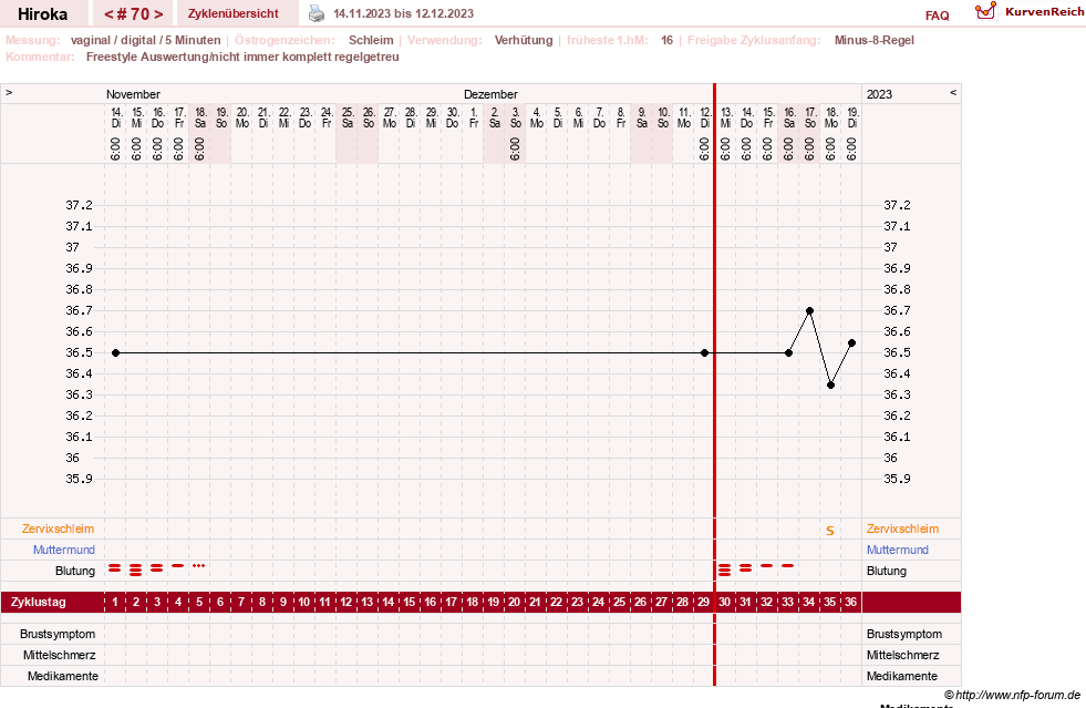 NFP-Kurve User #15010