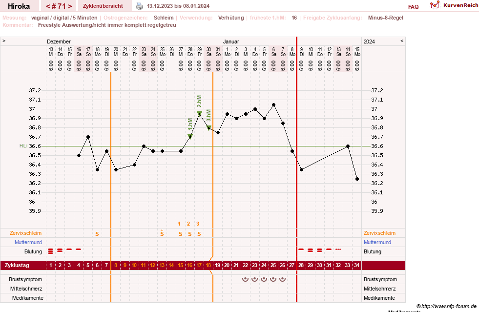 NFP-Kurve User #15010