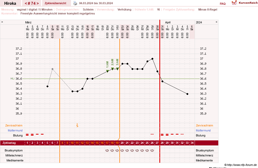 NFP-Kurve User #15010