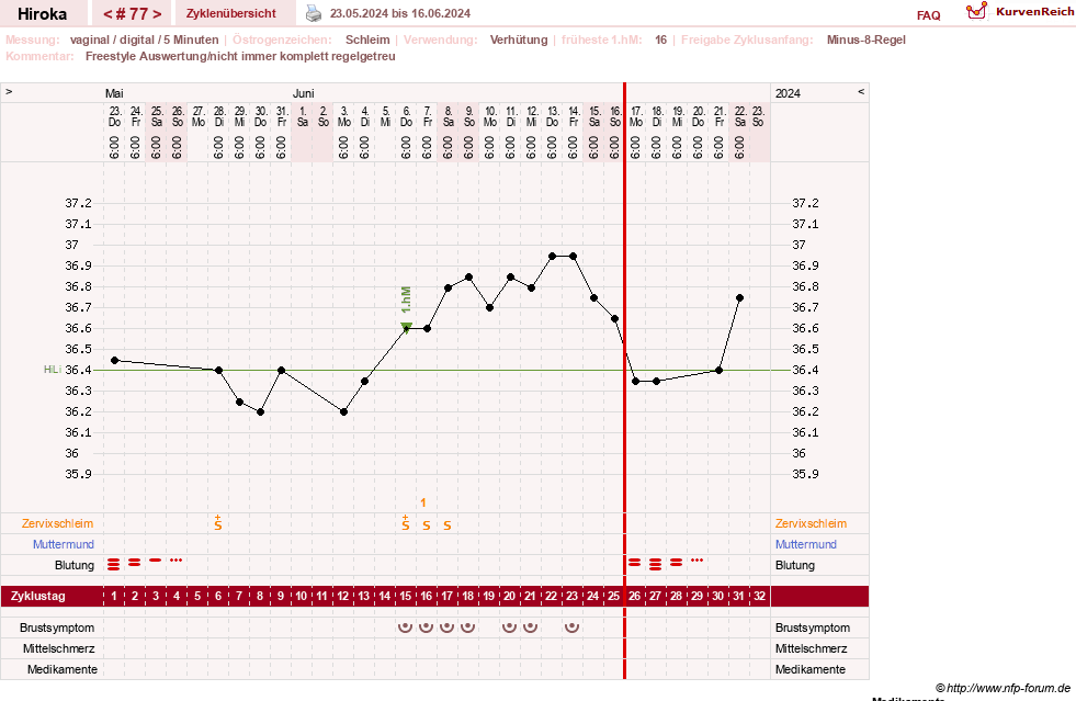NFP-Kurve User #15010