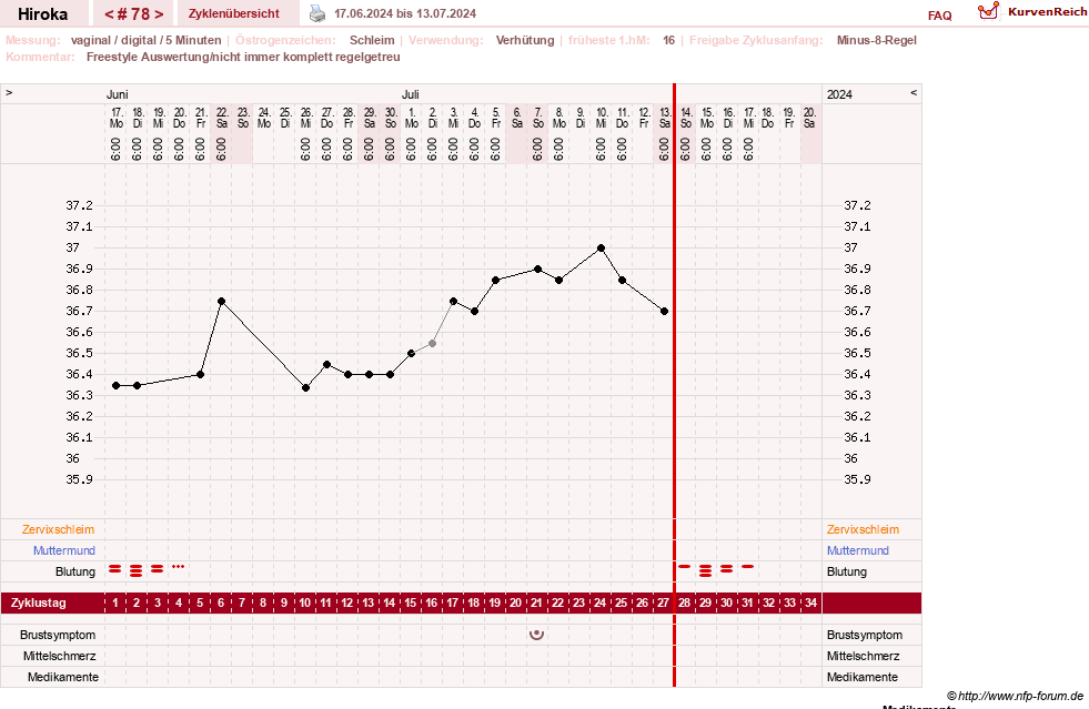 NFP-Kurve User #15010