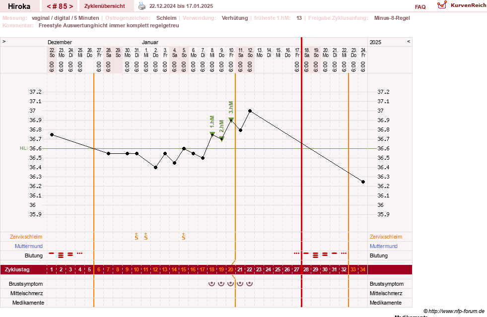 NFP-Kurve User #15010