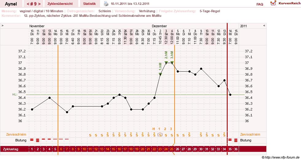 NFP-Kurve User #15046