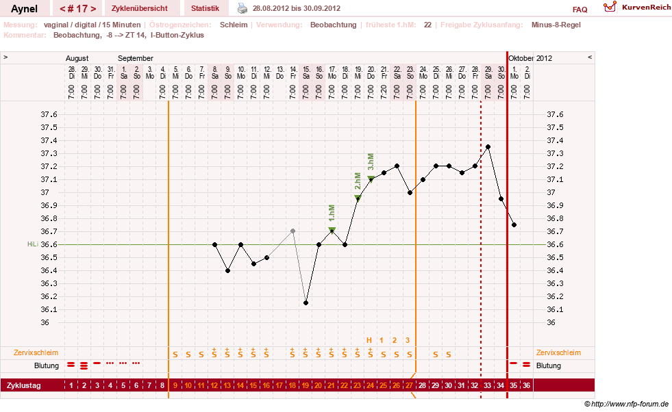 NFP-Kurve User #15046