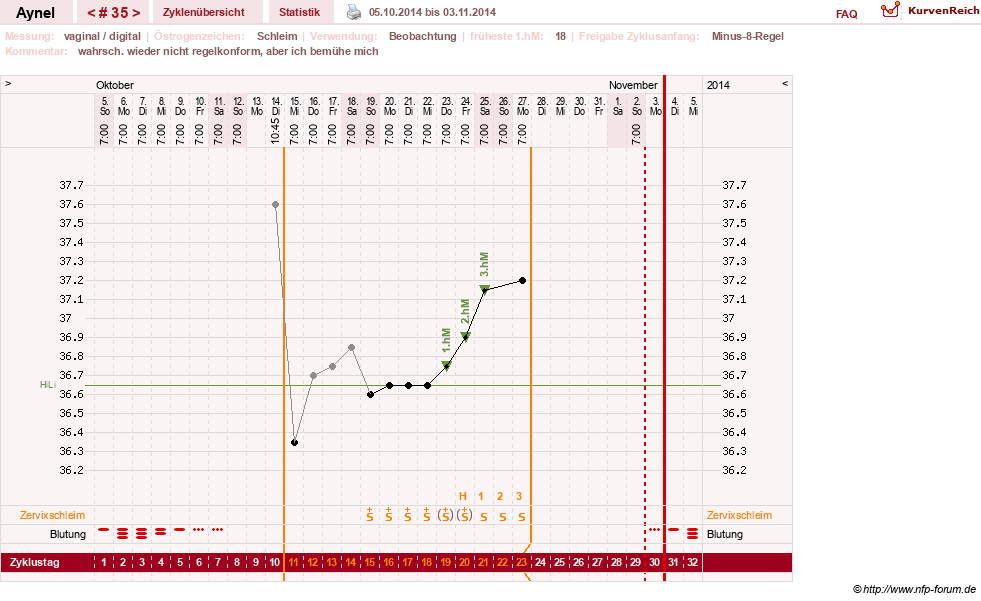 NFP-Kurve User #15046
