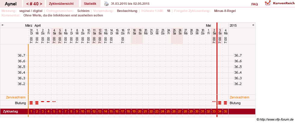 NFP-Kurve User #15046