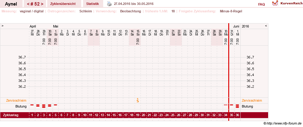 NFP-Kurve User #15046