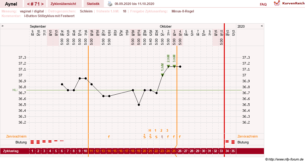 NFP-Kurve User #15046