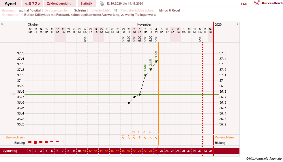 NFP-Kurve User #15046