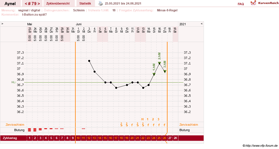 NFP-Kurve User #15046